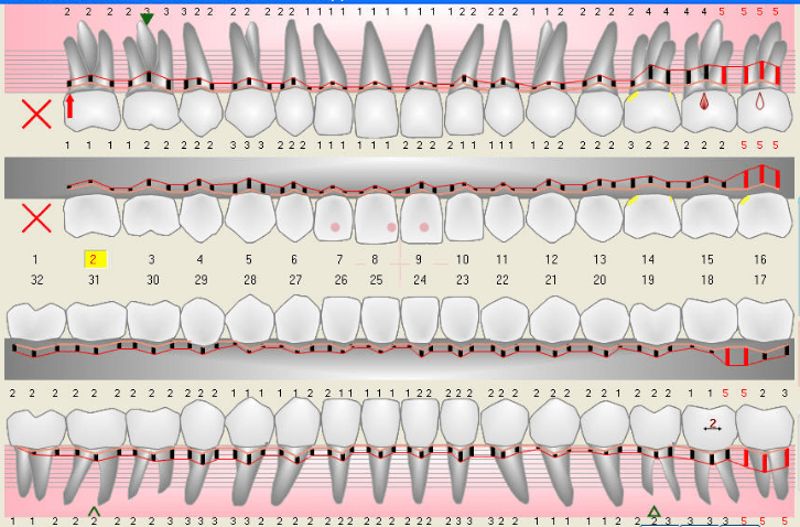 6 Point Perio Chart My XXX Hot Girl