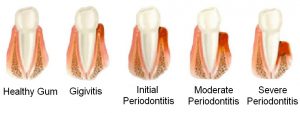 periodontology